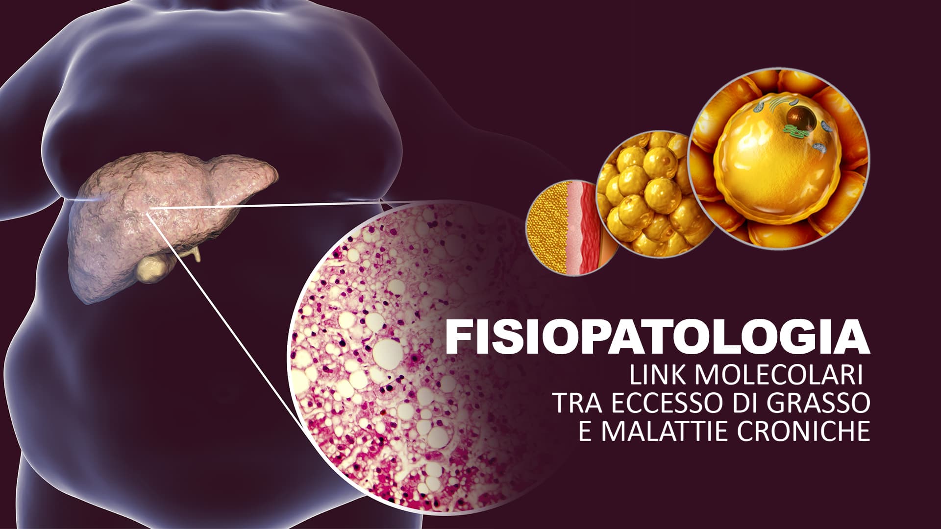 Fisiopatologia: link molecolari tra eccesso di grasso e malattie 