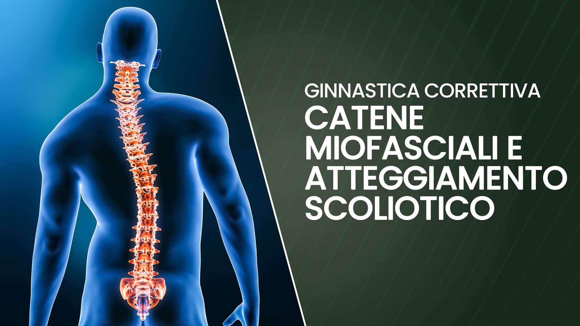 Catene Miofasciali e atteggiamento scoliotico