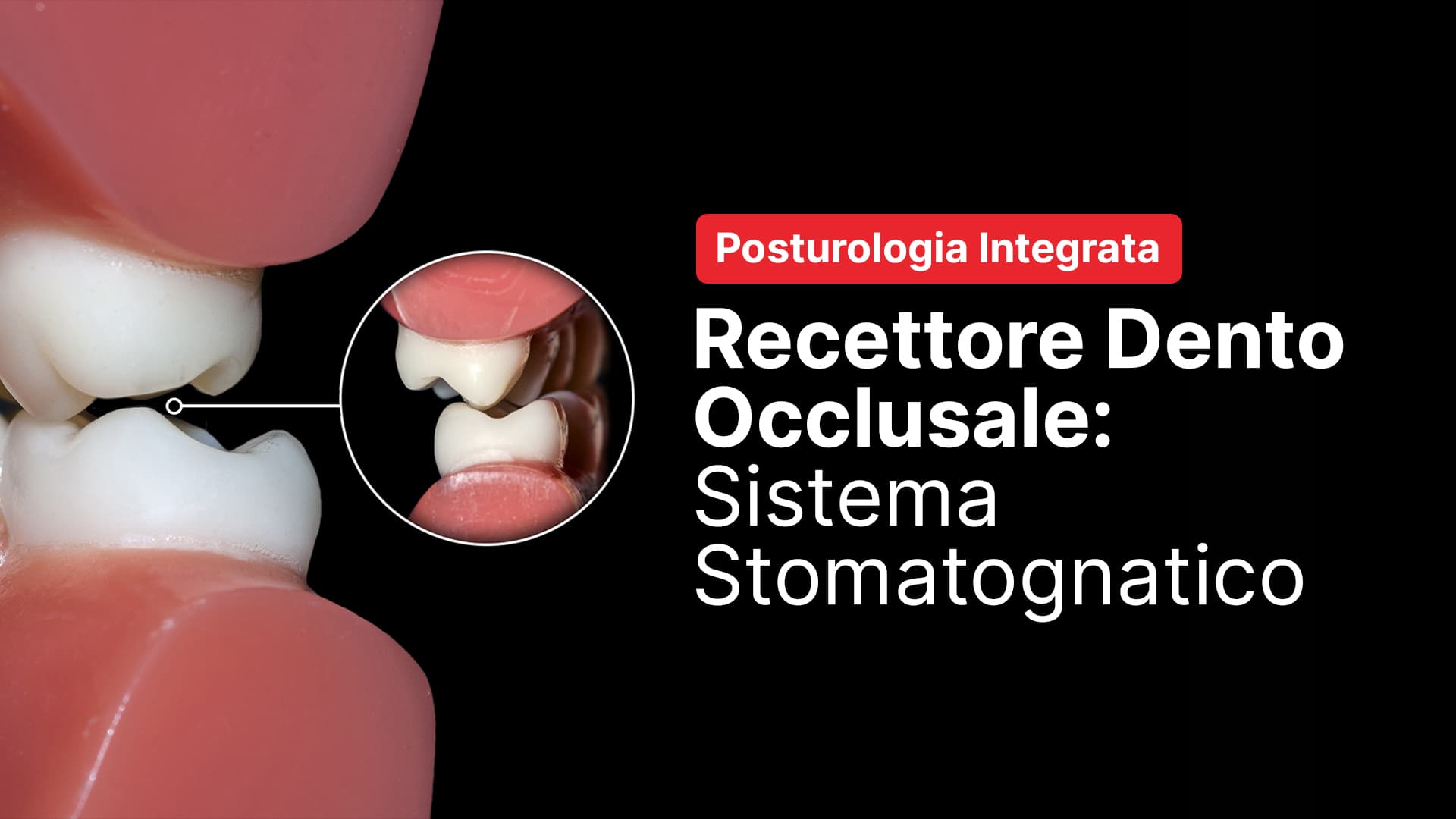 Recettore dento occlusale: sistema stomatognatico