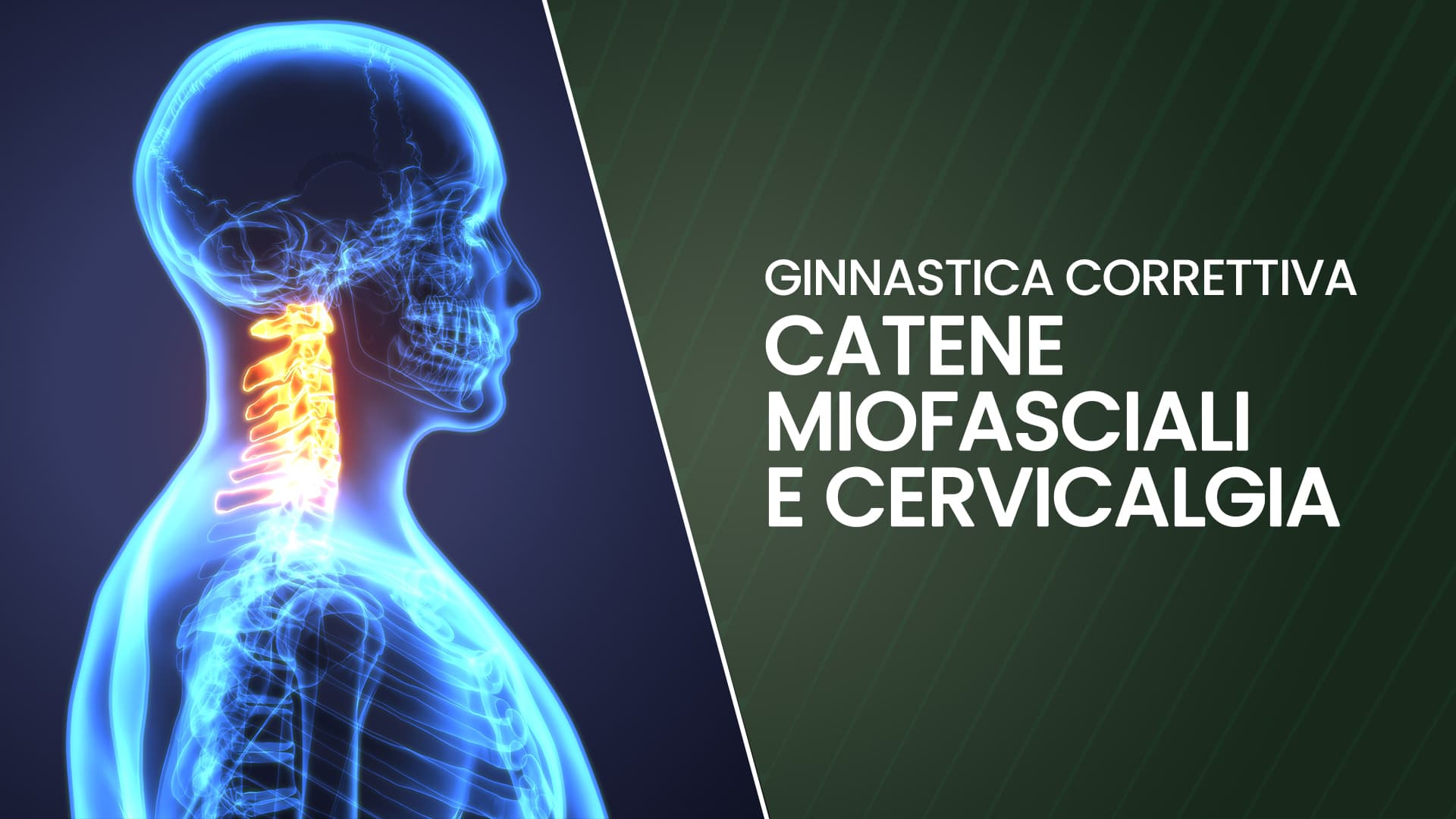 Catene miofasciali e cervicalgia: analisi, approccio ed esercizi