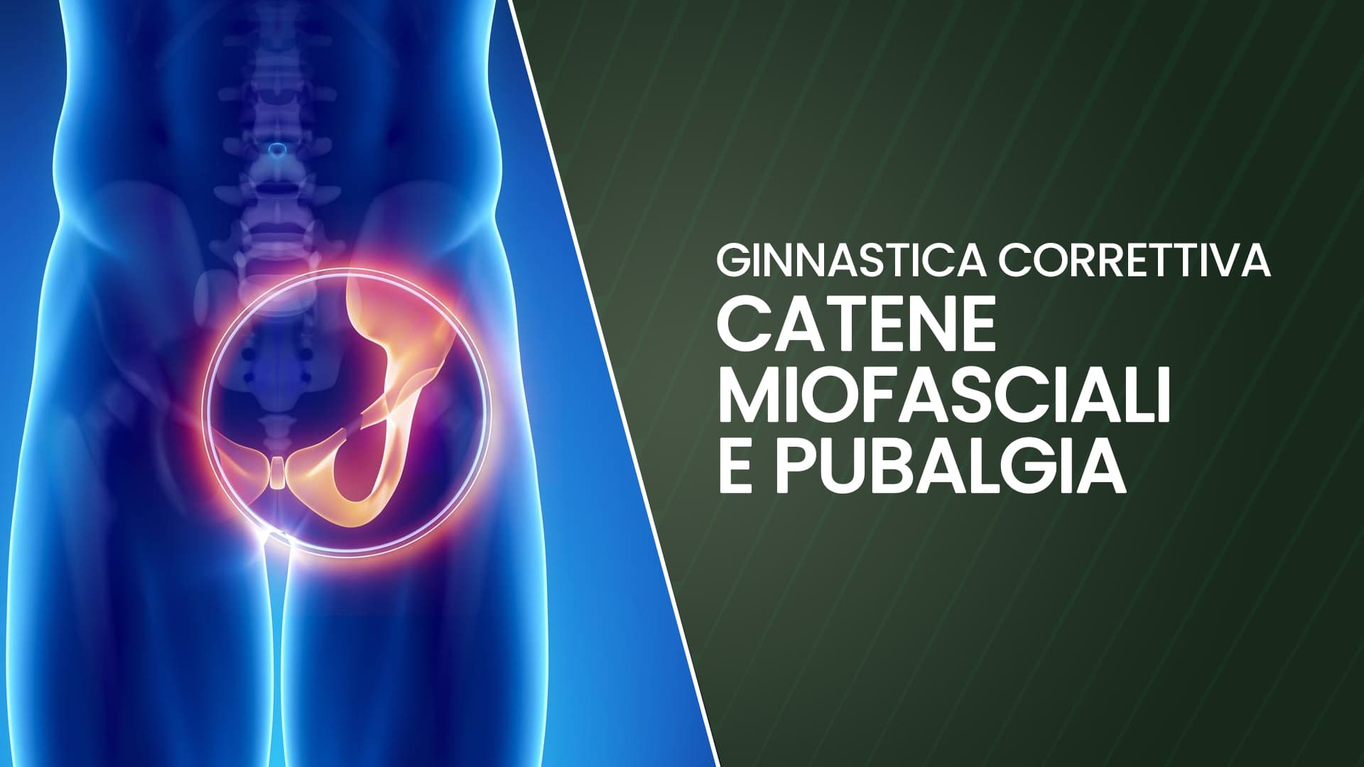 Catene miofasciali e pubalgia