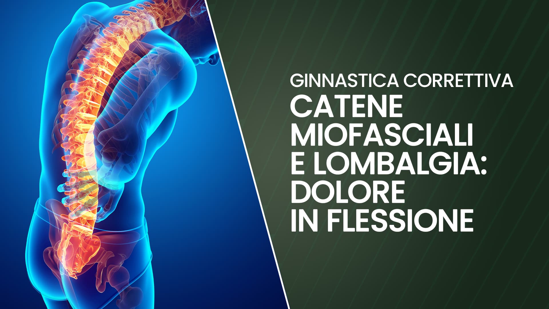 Catene miofasciali e lombalgia: dolore in flessione