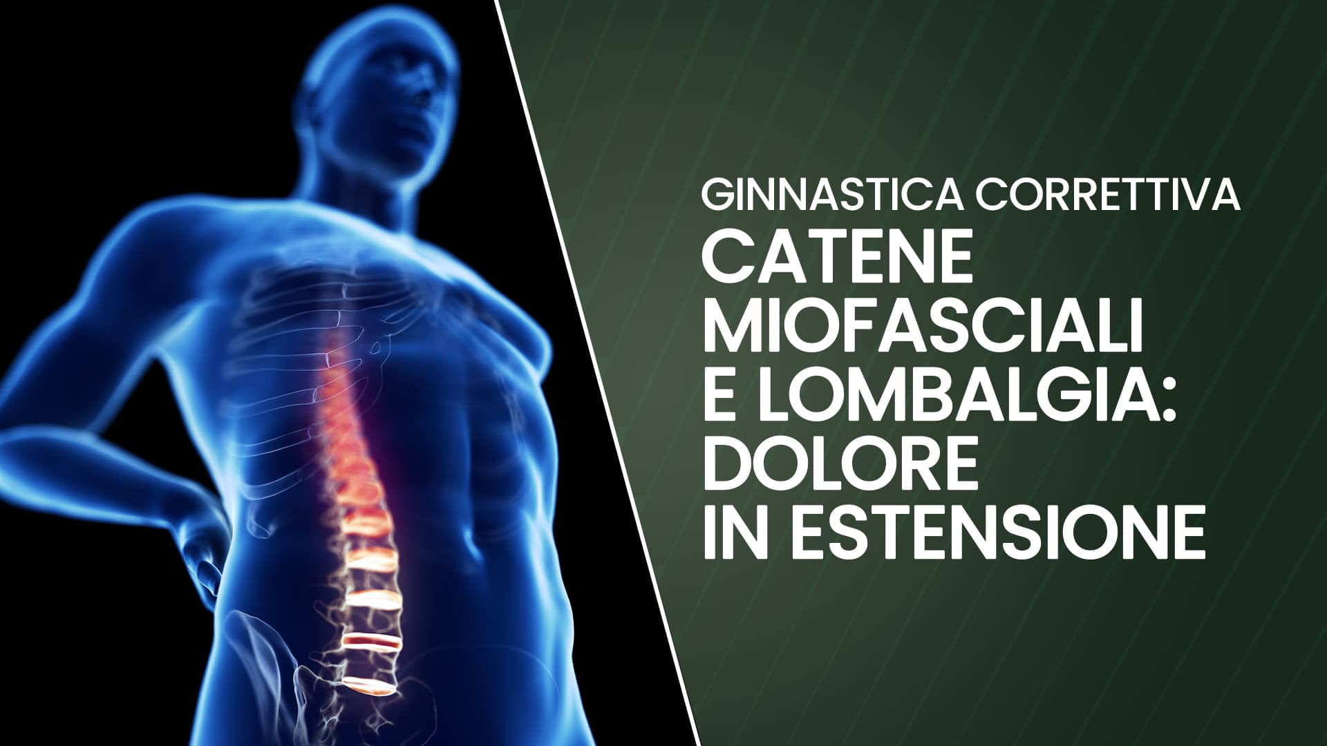 Catene Miofasciali e lombalgia (dolore in estensione)